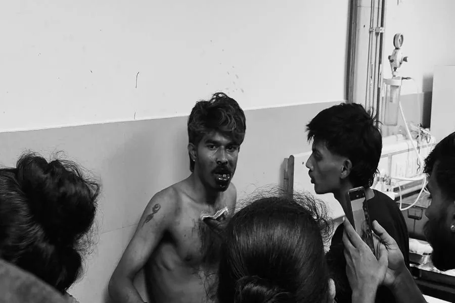 जमशेदपुर फायरिंग: कदमा में विवाद के बीच युवक पर गोली चलाने से सनसनी