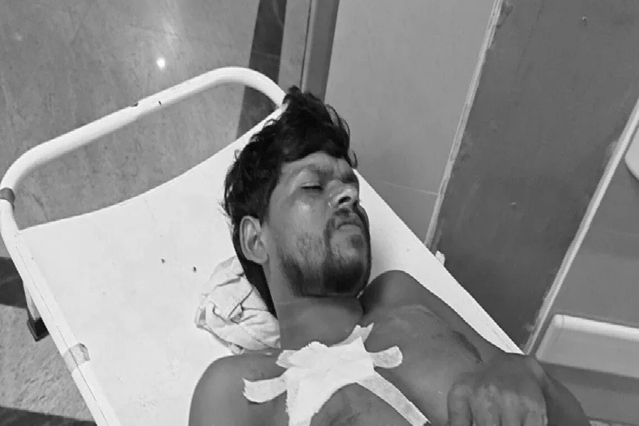 टेल्को विवाद: स्टील प्लांट कर्मी पर हमला, एमजीएम अस्पताल में भर्ती