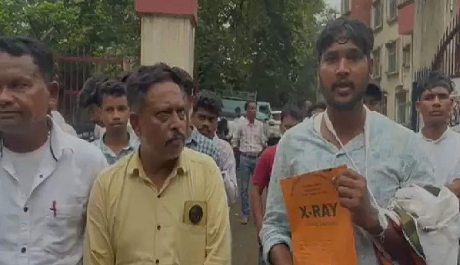 जमशेदपुर में भतीजे के इलाज के लिए निकले चाचा पर बाइक सवारों ने किया बर्बर हमला