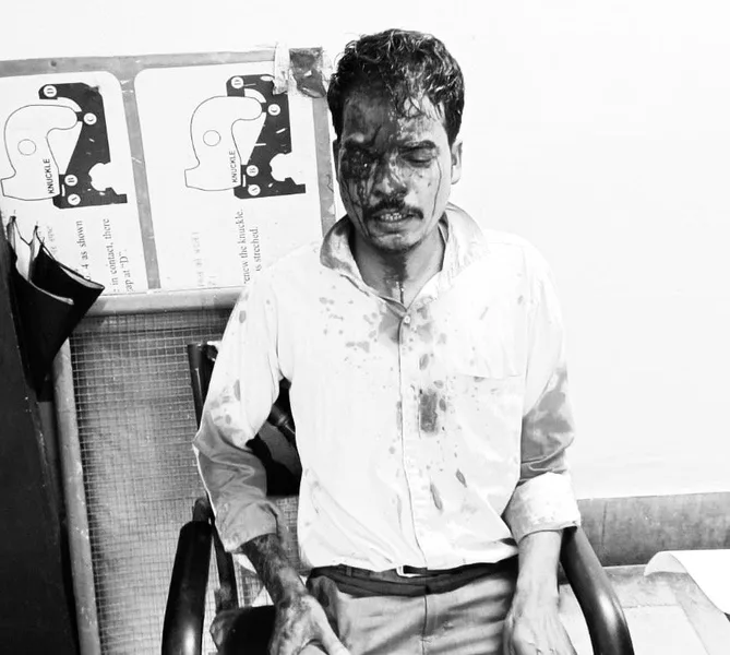 परसुडीह में नाइट ड्यूटी से लौट रहे रेलवे SSE पर चाकू से हमला, हमलावर की खोज जारी